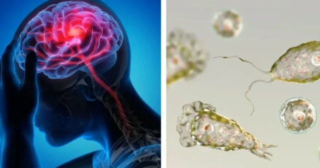 brain virus-ztJgpaZxvB.webp