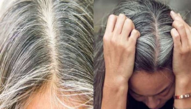 white hair issue-tpQVFyCmW7.jpeg